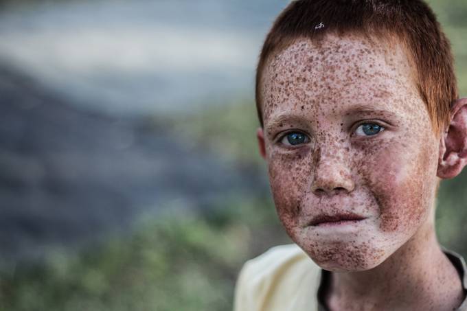 freckles by cameronperko - Natural Light Photo Contest