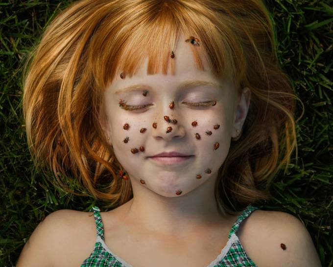 These Photos Of People With Freckles Will Make You Want Many Freckles