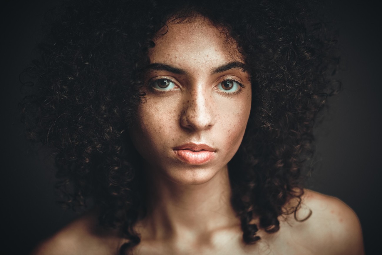 18+ Hypnotizing Portraits Of Faces With Freckles