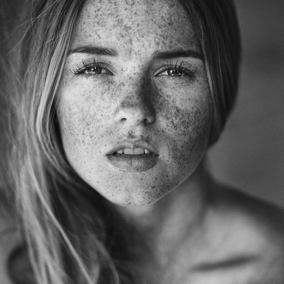 We Love Freckles Photo Contest Winners