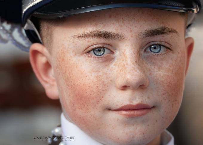 Freckles by Prijaznica - Image Of The Month Photo Contest Vol 54